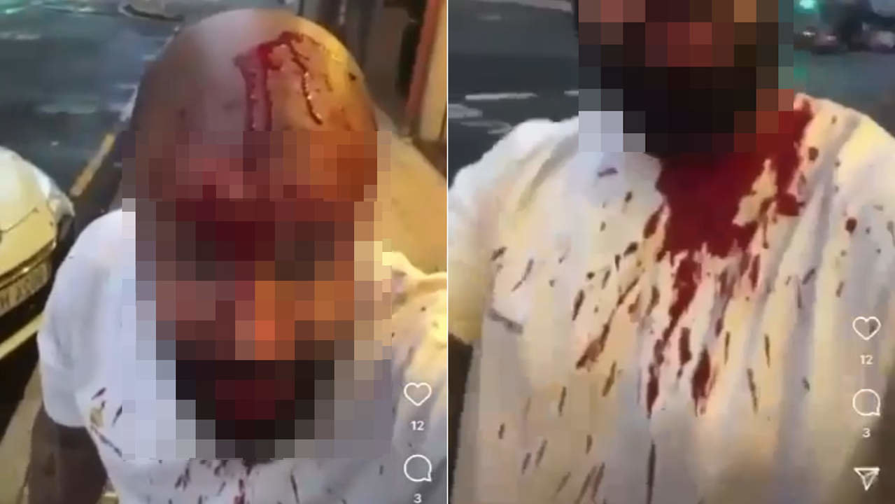  La víctima mostró sus heridas en redes sociales tras la trifulca en Vilagarcía. DP 