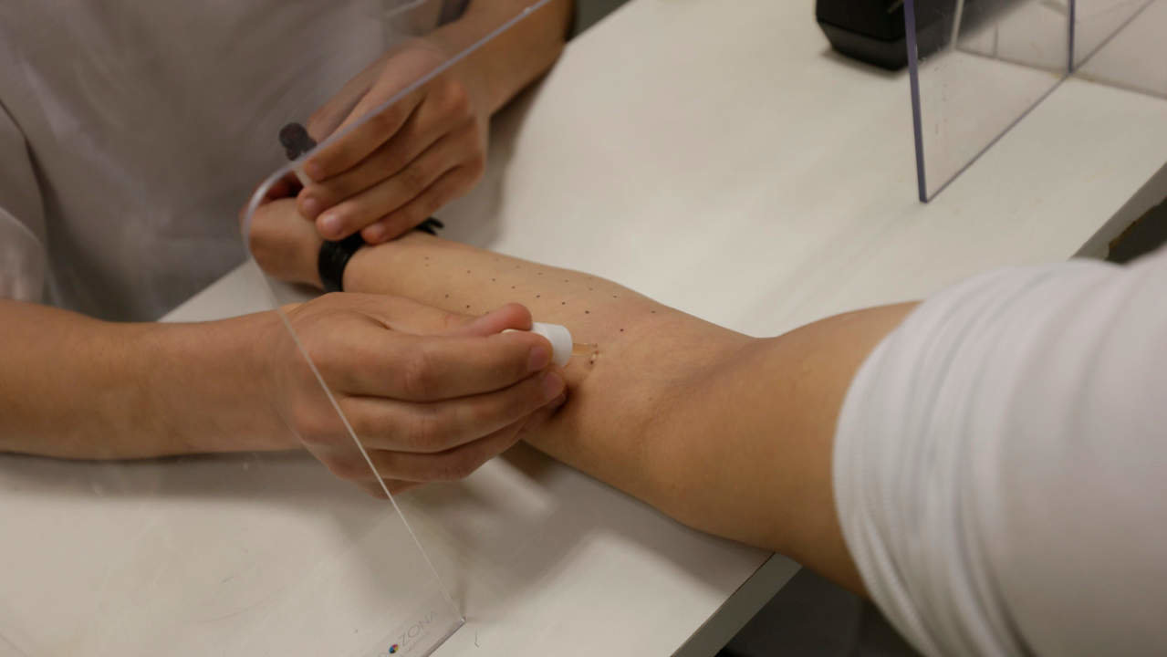  Un santiario realiza una prueba alérgica a un paciente. GONZALO GARCÍA 